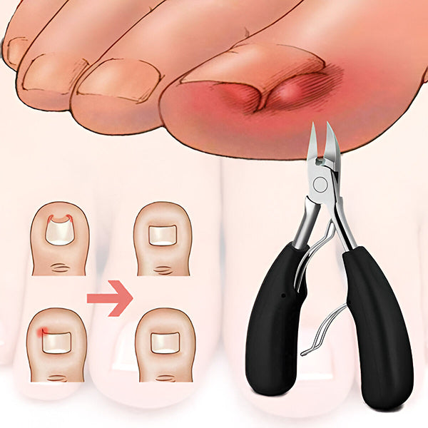 NAILPRO | Profesionální sada nůžek na nehty pro silné a zarostlé nehty (5 kusů)